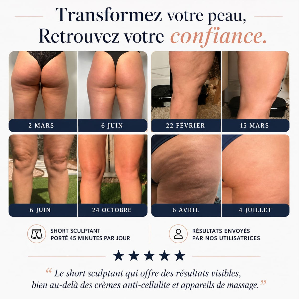 Shorty Sculptant : Ventre Plat, Fesses Galbées & Anti-Cellulite